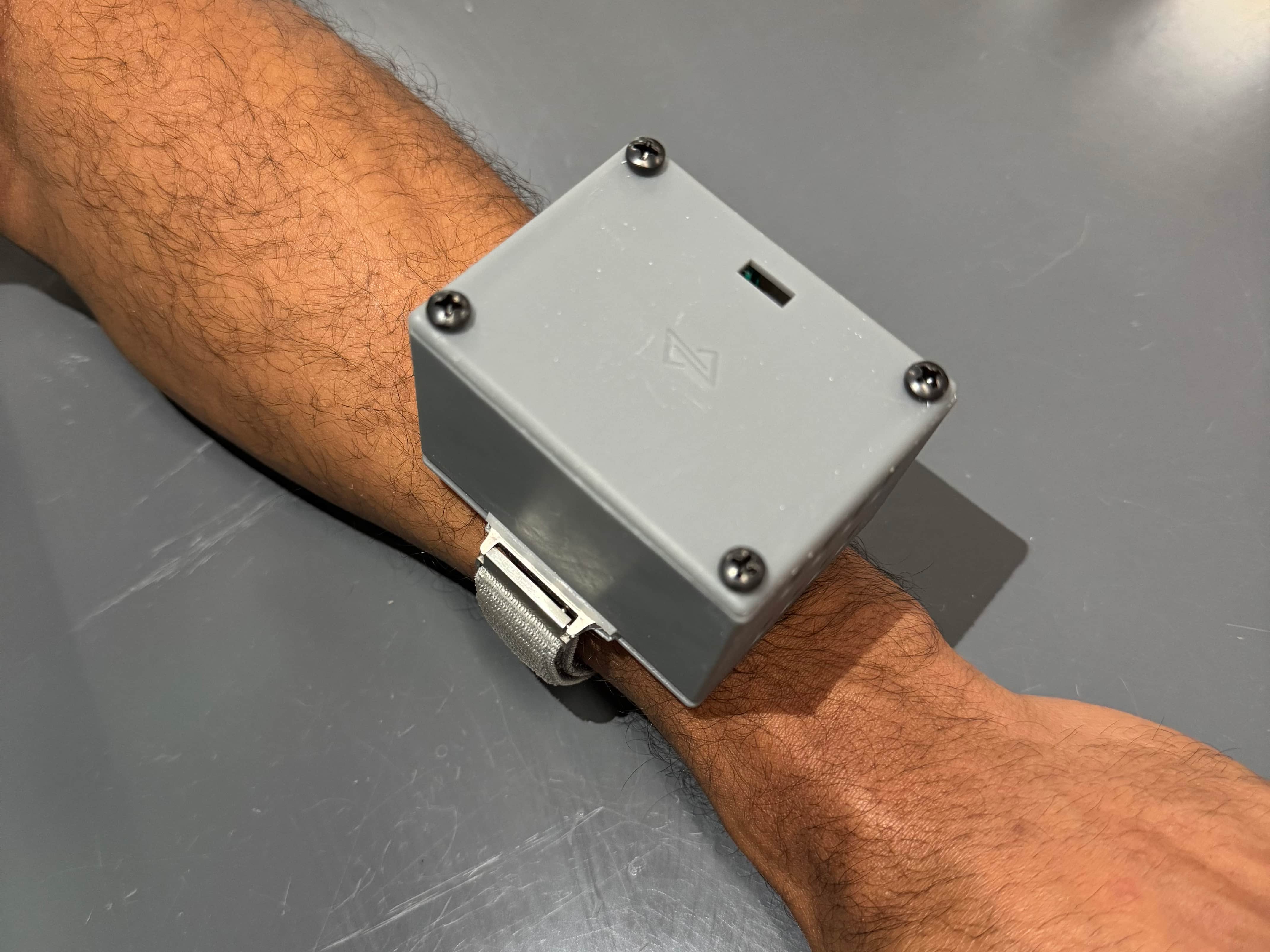 A gray box sits on someone's arm like a watch